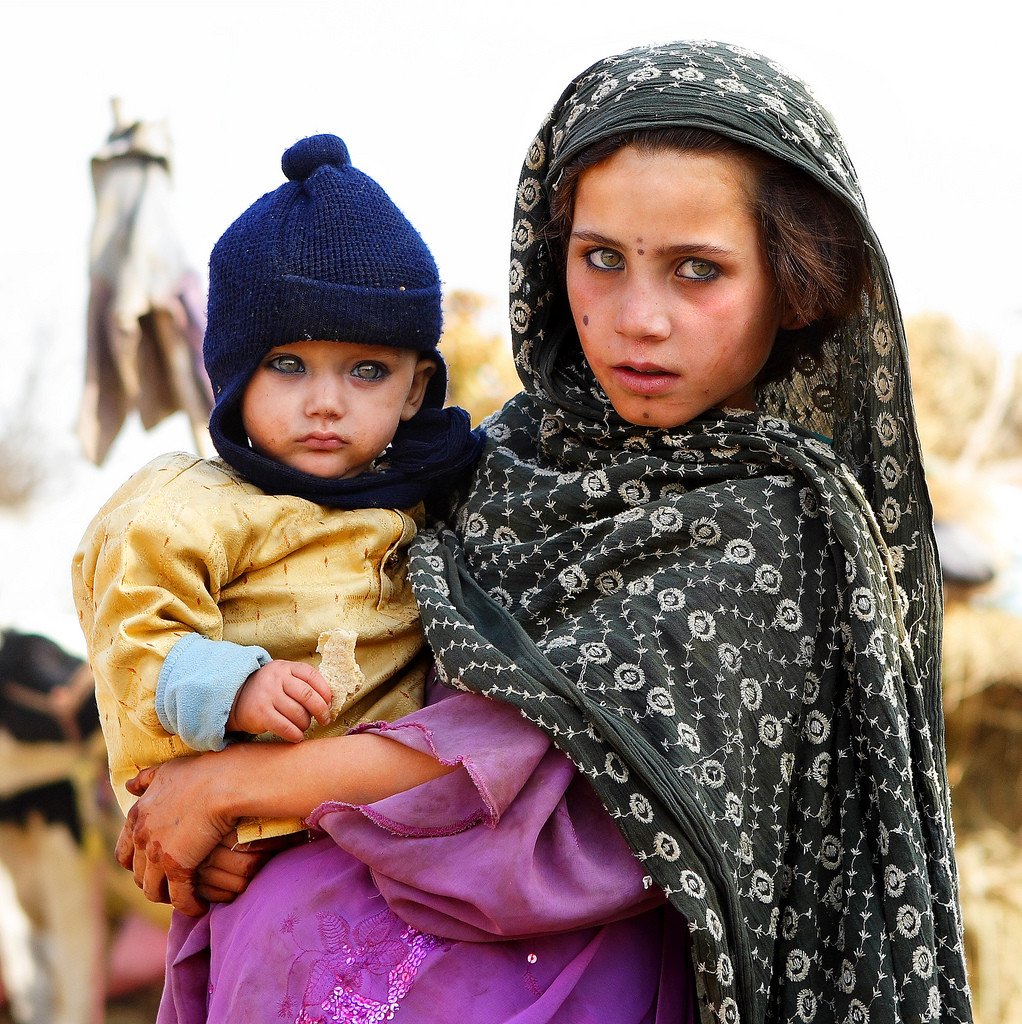 BEAUTIFUL EYES! Human Diversity